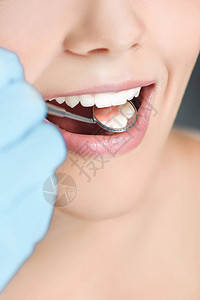 用牙科镜检查妇女牙齿的牙科图片