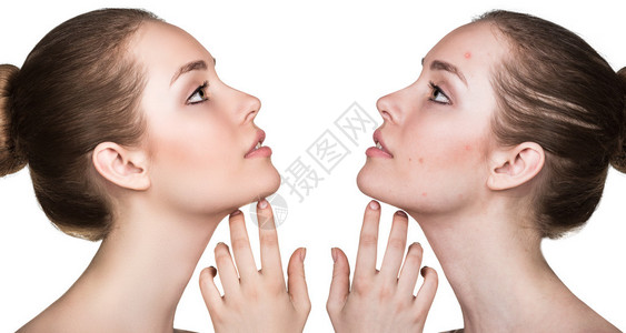 女皮肤问题治疗前后对比图背景图片