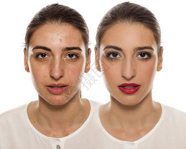 化妆前后皮肤有问题的女脸部比较肖像图图片