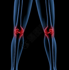 身体骨骼有近腿的伤口膝盖图片