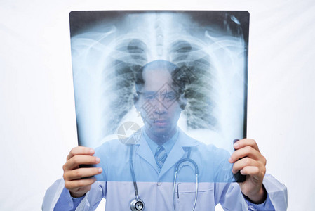 医生在他手中检查肺部X光片图片