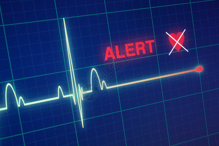 心脏监护仪上的平线警报图片