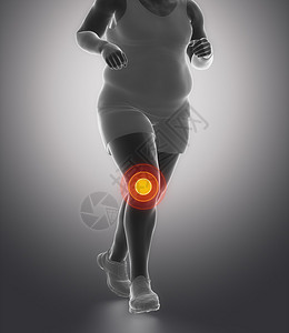肥胖奔跑的人和膝关节疼痛图片