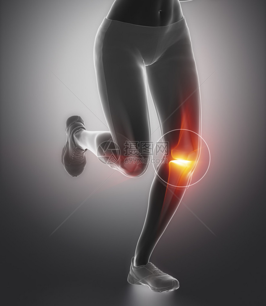 侧重于运动受伤时的膝图片
