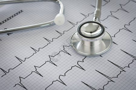 心脏病患者心电图表上的听诊器心脏病专图片