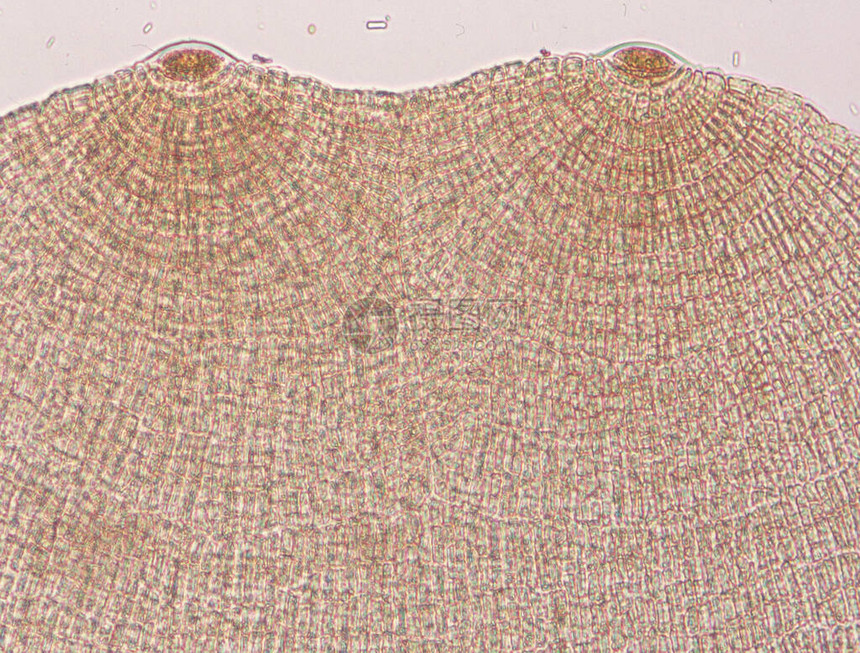 在显微镜100x下海藻的二缺图片