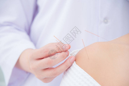 在病人肩膀上用手挨紧的针刺替代医学概念图片