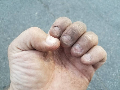 一只脏手脏兮的指甲被咬得令人作呕图片
