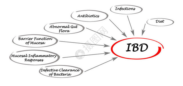 炎症肠病的原因图片
