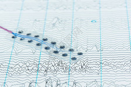 脑波记录概念在脑细胞造影的脑波背景上图片