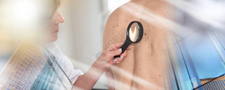 皮肤科医生检查患者背部的皮图片