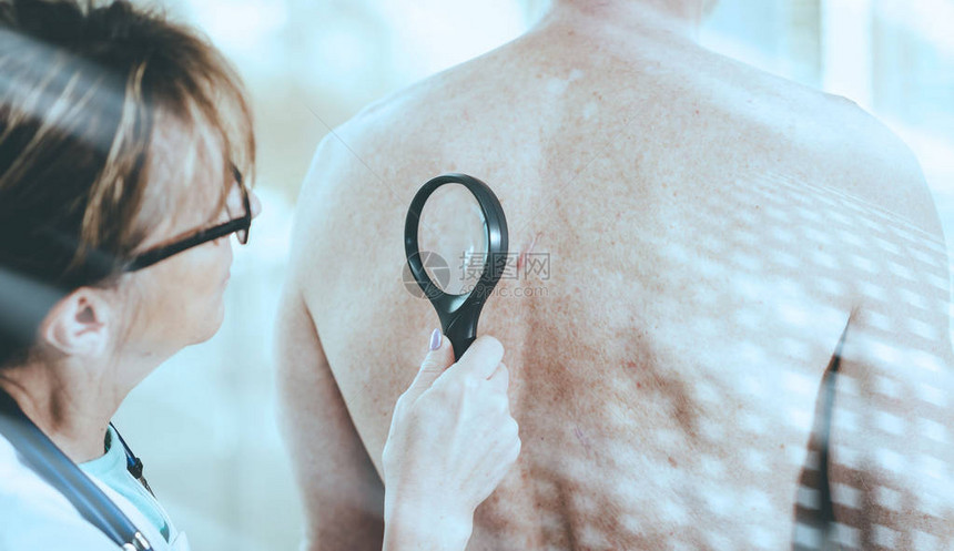 皮肤学家检查病人背部皮肤光效图片