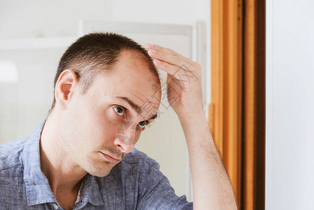 m型脱发男型脱发问题概念年轻的白种人看着镜子担心秃顶男背景
