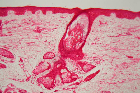 显微镜下有毛囊的皮肤图片