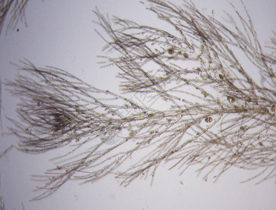 显微镜下的红藻高清图片