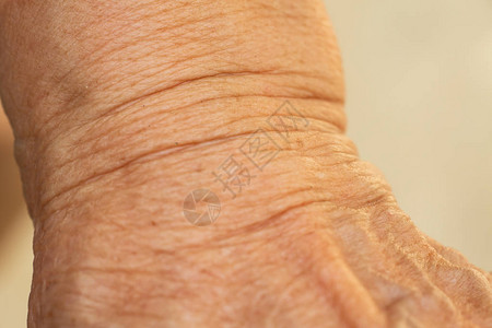 高级女手臂皱纹特写和宏观拍摄选择聚焦亚洲身体皮肤部分医疗保健概图片