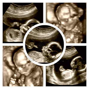 怀孕4个月3d胎儿超图片