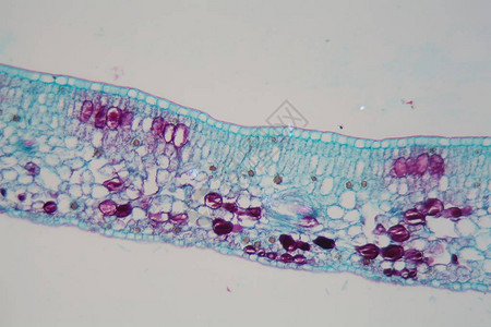 显微镜下表皮和叶绿体受损的植物叶片细胞损害是图片