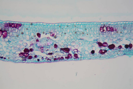 显微镜下表皮和叶绿体受损的植物叶片细胞损害是图片