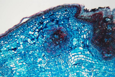 显微镜下患病植物茎的蓝色细胞图片