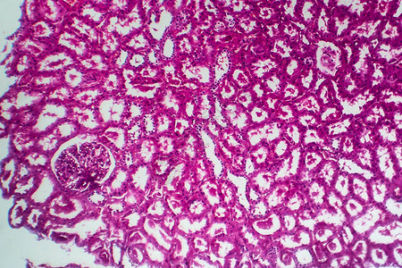肿瘤萎缩浅显微镜显背景图片