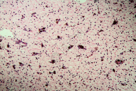 具有肝细胞的Axolot两栖动背景图片