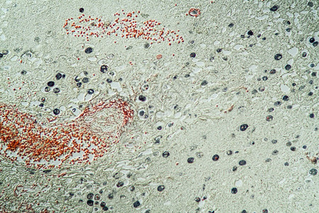 显微镜下的阿莫埃巴寄生虫组图片