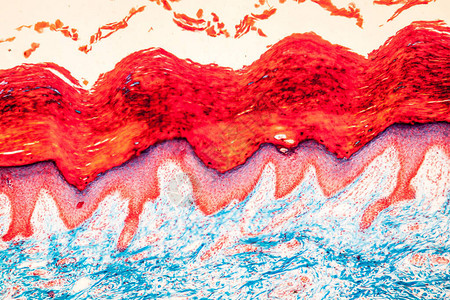显微镜下的疤皮肤组图片