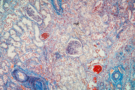 显微镜下的营养肾脏组图片