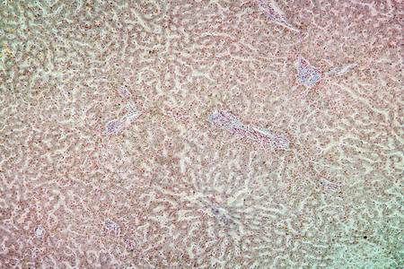 显微镜下的肝分裂组图片
