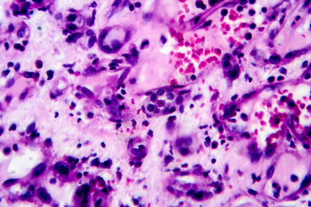 内膜肾炎光显微镜显微镜下照片背景图片