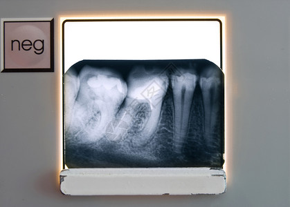 拿着牙齿X光片背景图片