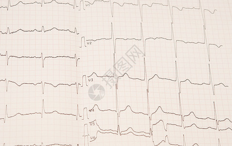 后台使用心律图图片