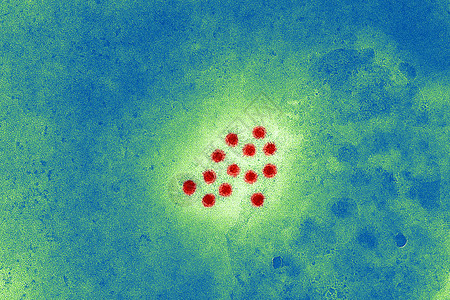 显微镜下的肝炎背景图片