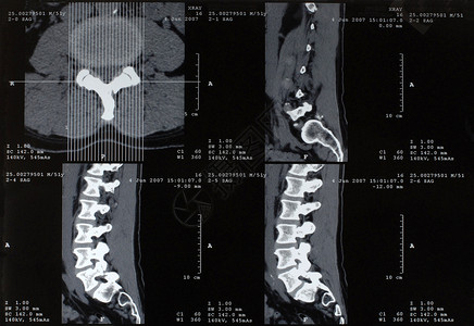 男脊柱x射线图片
