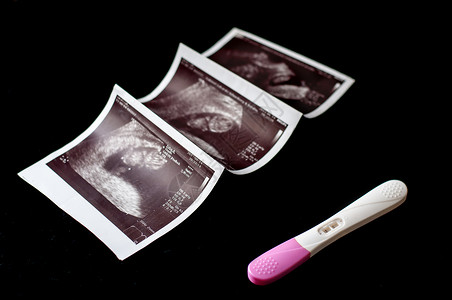 怀孕测试和超声波图片背景图片