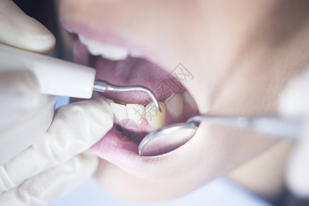 牙医在诊所用牙医仪器检查牙科检查清洁图片