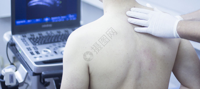 超声辅助生态学组织内经皮电解肩部诊断在医疗中心IPE理疗诊所理图片