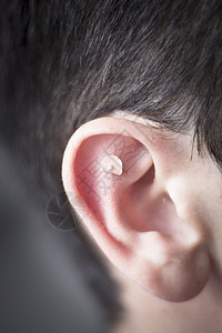 耳疗东方针灸耳籽贴膏药耳疗治理医院门诊理疗师图片