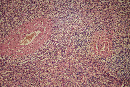 在显微镜下人体脾脏细胞中具有慢图片