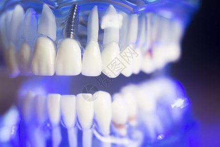 牙齿正畸牙科教学模型与牙龈牙釉质牙菌斑牙根背景图片