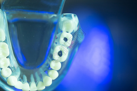 牙齿正畸牙科教学模型与牙龈牙釉质背景图片