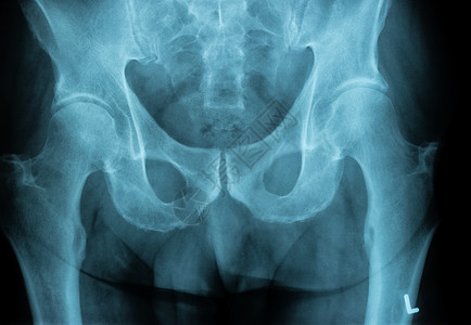 人体身部分的人类胸透X光图像背景