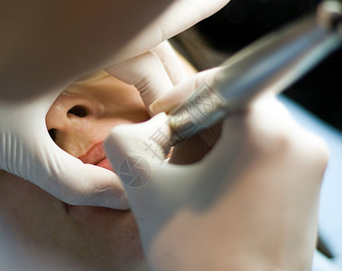 检查病人牙齿的牙图片
