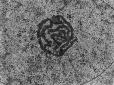 显示核仁的透射电子显微镜TEM显微照片纤维成分显示为称核仁的厚盘绕细丝背景图片