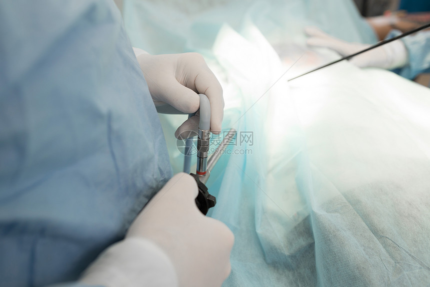 医生和辅助医疗团队在手术室对病人进行手术腹腔镜检查仪器在医院或诊所进行手术的外科医生医图片