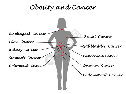 肥胖作为许多癌背景图片