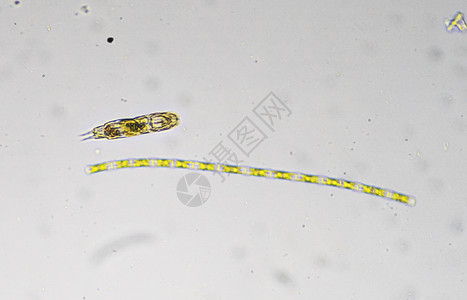 显微镜下的三头虫和藻类的婴儿微观世界图片
