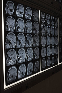 灯箱上的人脑核磁共振成像图片
