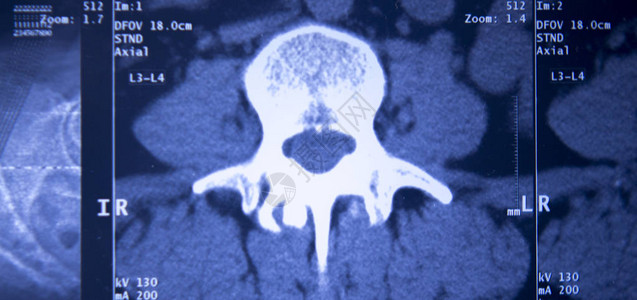 医院X射线胸骨脊椎骨盆MR图片